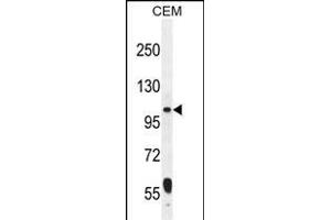 LARS2 Antibody (Center) (ABIN655050 and ABIN2844678) western blot analysis in CEM cell line lysates (35 μg/lane). (LARS2 anticorps  (AA 418-446))