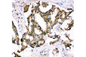 IHC analysis of Crk p38 using anti-Crk p38 antibody (ABIN3042758). (Crk anticorps  (AA 2-246))