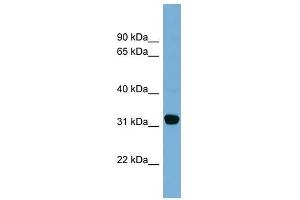 Carbonyl Reductase 1 antibody used at 1 ug/ml to detect target protein. (CBR1 anticorps  (Middle Region))