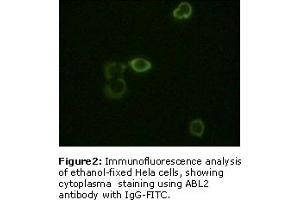 Image no. 2 for anti-ABL2 (ABL2) antibody (ABIN230671) (ABL2 anticorps)