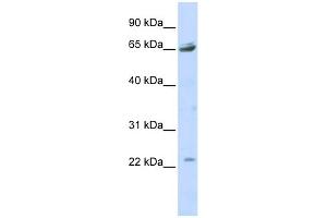 WB Suggested Anti-P2RX2 Antibody Titration:  0. (P2RX2 anticorps  (Middle Region))