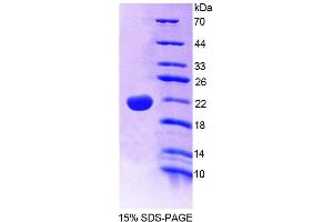SDS-PAGE analysis of Human PTPN13 Protein. (PTPN13 Protéine)