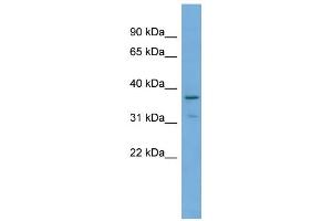 WB Suggested Anti-TOB1 Antibody Titration: 0.