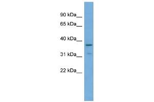 WB Suggested Anti-TOB1 Antibody Titration: 0. (Protein Tob1 (TOB1) (Middle Region) anticorps)