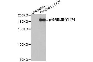 Western blot analysis of extracts from A431 cells, using Phospho-GRIN2B-Y1474 antibody (ABIN2988034). (GRIN2B anticorps  (pTyr1474))