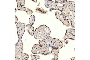 IHC analysis of U1A/SNRPA using anti-U1A/SNRPA antibody (ABIN7600891). (SNRPA1 anticorps  (AA 25-218))
