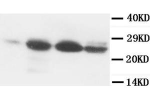 Western Blotting (WB) image for anti-B-Cell CLL/lymphoma 2 (BCL2) (AA 41-54) antibody (ABIN1105504) (Bcl-2 anticorps  (AA 41-54))