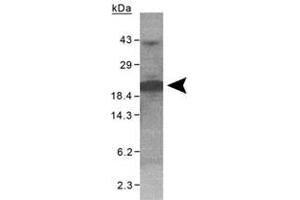 Western blot analysis of XAGE1 on purified His-XAGE1 (100 ug) with XAGE1 polyclonal antibody . (XAGE1 anticorps)