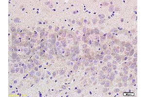 Formalin-fixed and paraffin embedded rat brain labeled with Anti- NCX2/SLC8A2 Polyclonal Antibody, Unconjugated (ABIN676478) at 1:200 followed by conjugation to the secondary antibody and DAB staining (SLC8A2 anticorps  (AA 601-700))