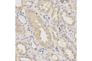 Immunohistochemistry of paraffin-embedded human kidney using DCTN2 antibody at dilution of 1:200 (x40 lens) (Dynamitin anticorps)