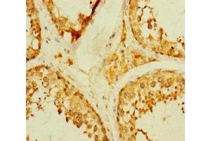 Immunohistochemistry of paraffin-embedded human testis tissue using ABIN7172741 at dilution of 1:100 (TADA2B anticorps  (AA 29-328))