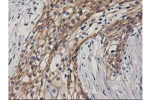 Image no. 7 for anti-Catenin (Cadherin-Associated Protein), beta 1, 88kDa (CTNNB1) antibody (ABIN1496889)