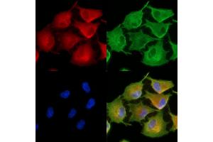 ABIN6262683 and ABIN6278907 staining  cells by IF/ICC. (ITGA8 anticorps  (C-Term))