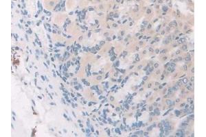 Detection of GDF5 in Mouse Stomach Tissue using Polyclonal Antibody to Growth Differentiation Factor 5 (GDF5)