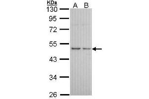 WB Image Sample (30 ug of whole cell lysate) A: A431 , B: H1299 10% SDS PAGE antibody diluted at 1:1000 (HRH3 anticorps  (C-Term))