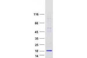 Validation with Western Blot