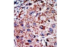 Image no. 2 for anti-Phosphofructokinase, Liver (PFKL) (C-Term) antibody (ABIN360629) (PFKL anticorps  (C-Term))