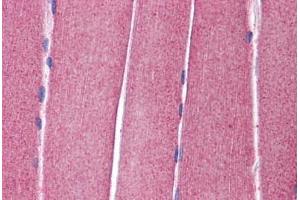 Human Skeletal Muscle: Formalin-Fixed, Paraffin-Embedded (FFPE)