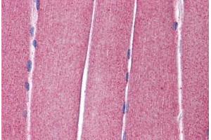 Human Skeletal Muscle: Formalin-Fixed, Paraffin-Embedded (FFPE) (Kv3.4 anticorps  (AA 252-301))