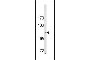 Western blot analysis of ARGBP2 Antibody (N-term) (ABIN652279 and ABIN2841160) in MDA-M cell line lysates (35 μg/lane).