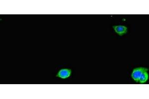 Immunofluorescent analysis of HepG2 cells using ABIN7171544 at dilution of 1:100 and Alexa Fluor 488-congugated AffiniPure Goat Anti-Rabbit IgG(H+L) (TAS2R38 anticorps  (AA 212-251))