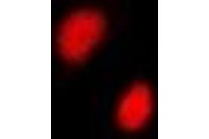 Immunofluorescent analysis of CGBP staining in A549 cells. (CXXC1 anticorps)
