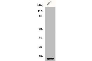 Western Blot analysis of A549 cells using Cystatin 11 Polyclonal Antibody (CST11 anticorps  (C-Term))