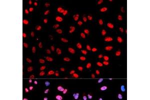 Immunofluorescence analysis of U2OS cells using Phospho-ESPL1(S1126) Polyclonal Antibody (Separase anticorps  (pSer1126))