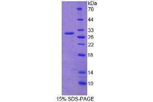 SDS-PAGE analysis of Human RRBP1 Protein. (RRBP1 Protéine)
