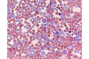 Immunohistochemistry (IHC) image for anti-ATP-Binding Cassette, Sub-Family C (CFTR/MRP), Member 5 (ABCC5) antibody (ABIN920695)