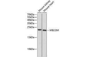 Western blot analysis of extracts of various cell lines, using MECOM antibody (ABIN6132516, ABIN6143677, ABIN6143679 and ABIN6221326) at 1:1000 dilution. (MECOM anticorps  (AA 1-120))