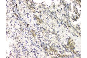 IHC analysis of RHOB using anti-RHOB antibody (ABIN6719538). (RHOB anticorps)