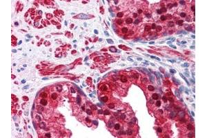 Human Prostate: Formalin-Fixed, Paraffin-Embedded (FFPE)