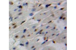 Used in DAB staining on fromalin fixed paraffin-embedded Heart tissue
