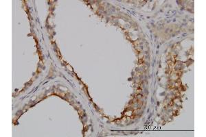 Immunoperoxidase of monoclonal antibody to GGT1 on formalin-fixed paraffin-embedded human testis.
