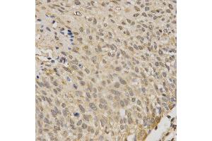 Immunohistochemistry (IHC) image for anti-serine/threonine Kinase 11 (STK11) (AA 134-433) antibody (ABIN3022973)