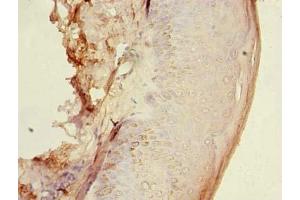 Immunohistochemistry of paraffin-embedded human skin tissue using ABIN7154963 at dilution of 1:100