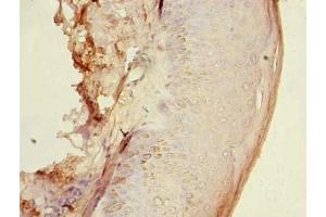 Immunohistochemistry of paraffin-embedded human skin tissue using ABIN7154963 at dilution of 1:100 (HEMK1 anticorps  (AA 1-338))
