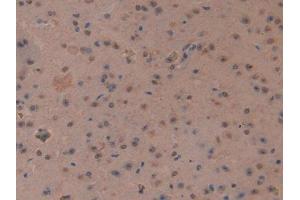 IHC-P analysis of Mouse Cerebrum Tissue, with DAB staining. (MT3 anticorps  (AA 1-68))