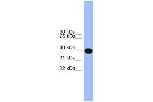 WB Suggested Anti-SERPINA1 Antibody Titration: 0. (SERPINA1 anticorps  (C-Term))
