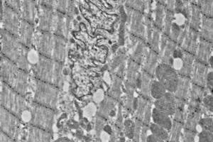 Immunoelectron microscopy analysis of LR white resin-embedded mouse heart using alpha Actinin 2 (ABIN7075510) at dilution of 1: 50. (Sarcomeric alpha Actinin anticorps)