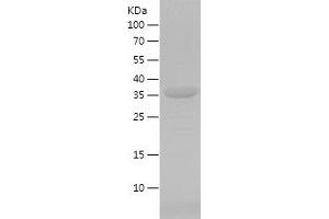 Western Blotting (WB) image for ATG5 Autophagy Related 5 (ATG5) (AA 138-275) protein (His-IF2DI Tag) (ABIN7121921)
