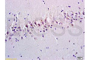 Formalin-fixed and paraffin embedded rat brain tissue labeled with Anti-Emp1/MUC1 Polyclonal Antibody, Unconjugated at 1:200, followed by conjugation to the secondary antibody and DAB staining (EMP1 anticorps  (AA 101-160))