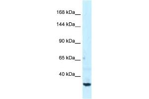 Western Blotting (WB) image for anti-Spectrin Beta, Non-Erythrocytic 1 (SPTBN1) (C-Term) antibody (ABIN2788921) (SPTBN1 anticorps  (C-Term))