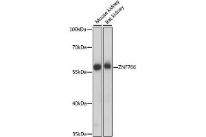 Western blot analysis of extracts of various cell lines, using ZNF766 antibody (ABIN7271530) at 1000 dilution. (ZNF766 anticorps  (AA 60-190))