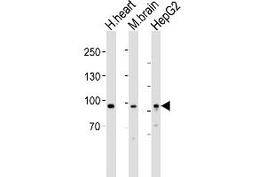All lanes : Anti-PROX1 Antibody (Center) at 1:1000 dilution Lane 1: human heart lysates Lane 2: mouse brain lysates Lane 3: HepG2 whole cell lysates Lysates/proteins at 20 μg per lane. (PROX1 anticorps  (AA 444-478))