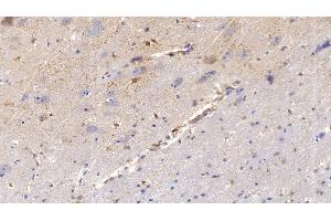 Detection of MMP2 in Human Cerebrum Tissue using Polyclonal Antibody to Matrix Metalloproteinase 2 (MMP2)