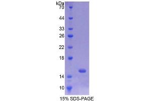 SDS-PAGE (SDS) image for BCL2 Binding Component 3 (BBC3) (AA 76-170) protein (His tag) (ABIN3209921)