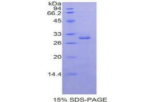 SDS-PAGE analysis of Human RORa Protein. (RORA Protéine)