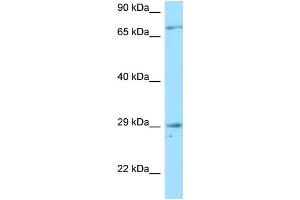 Western Blotting (WB) image for anti-Tumor Necrosis Factor Receptor Superfamily, Member 13B (TNFRSF13B) (N-Term) antibody (ABIN2789582)